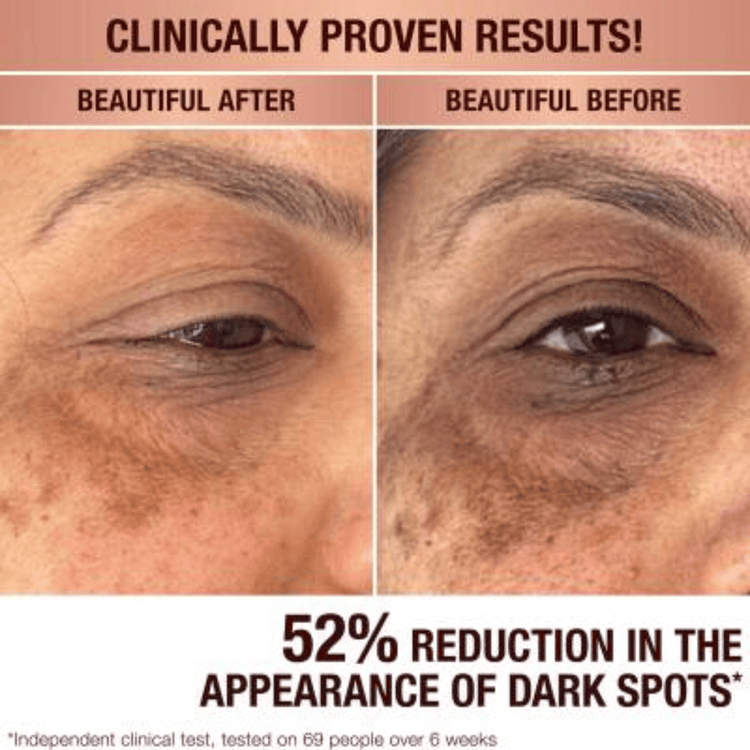 Charlotte Tilbury Skin Care Charlotte Tilbury Dark Spot Correcting Radiance Recovery Serum (30ml)