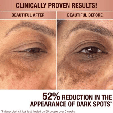 Charlotte Tilbury Skin Care Charlotte Tilbury Dark Spot Correcting Radiance Recovery Serum (30ml)