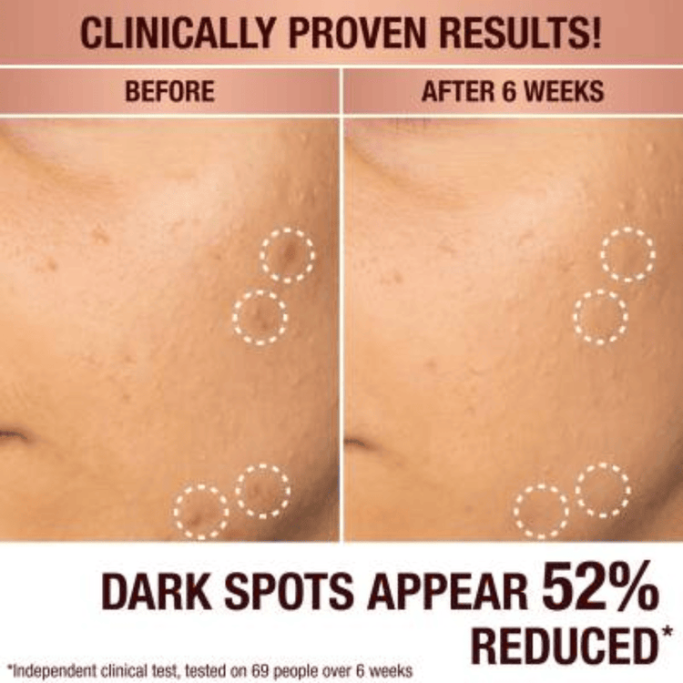 Charlotte Tilbury Skin Care Charlotte Tilbury Dark Spot Correcting Radiance Recovery Serum (30ml)