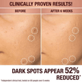 Charlotte Tilbury Skin Care Charlotte Tilbury Dark Spot Correcting Radiance Recovery Serum (30ml)