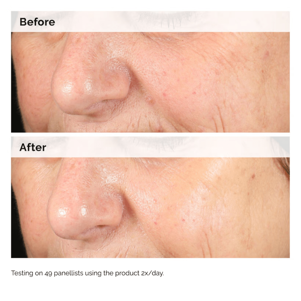 The Ordinary Skin Care The Ordinary Alpha Arbutin 2% + HA Serum (30ml, 60ml)