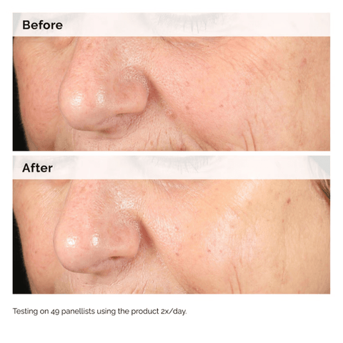 The Ordinary Skin Care The Ordinary Alpha Arbutin 2% + HA Serum (30ml, 60ml)
