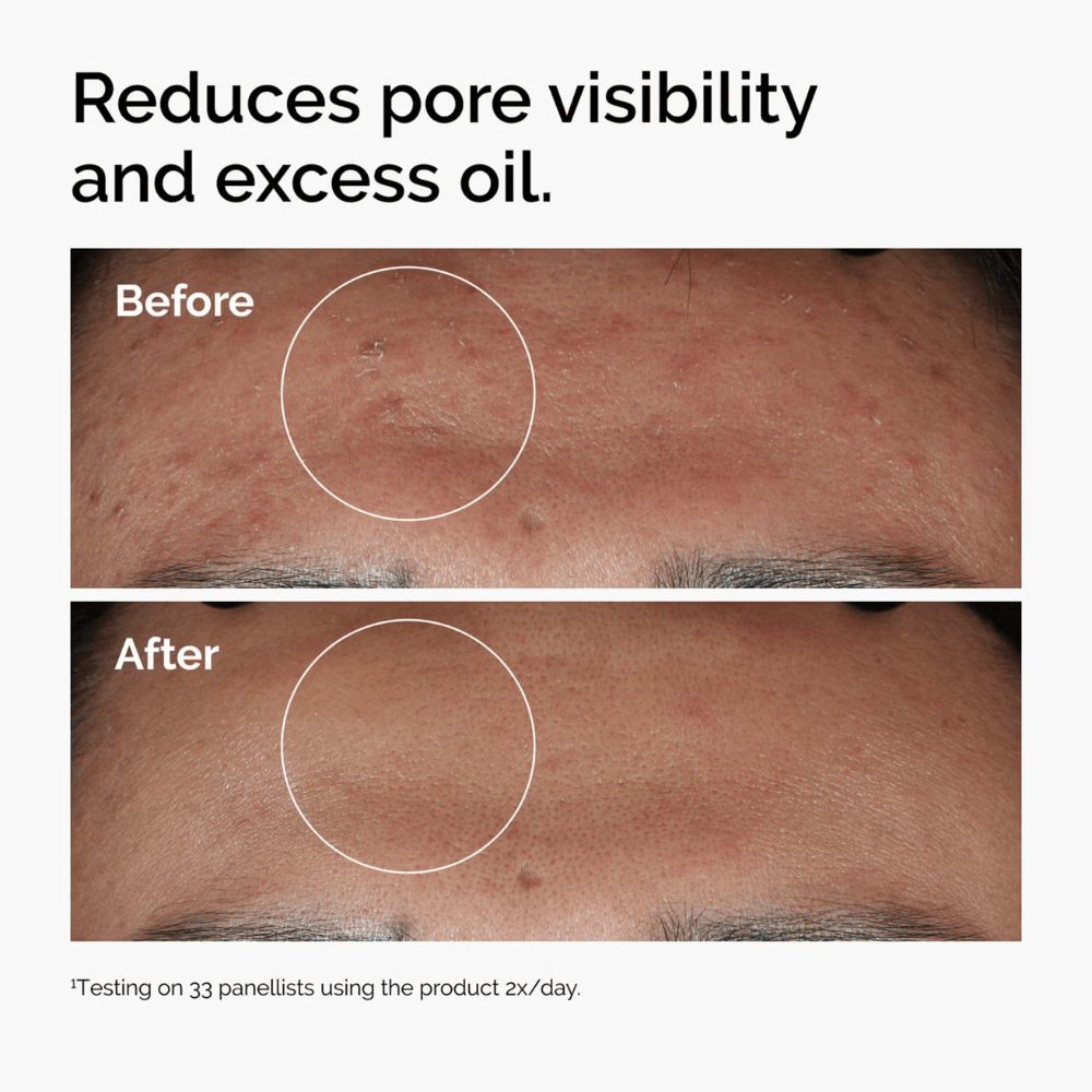 The Ordinary Skin Care The Ordinary Niacinamide 10% + Zinc 1% Serum (60ml)