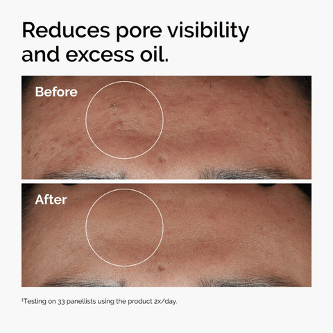 The Ordinary Skin Care The Ordinary Niacinamide 10% + Zinc 1% Serum (60ml)
